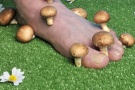 Nagelpilz?