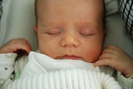 Im ersten Lebensjahr ist die Haut eines Babys noch nicht ganz «von dieser Welt». 