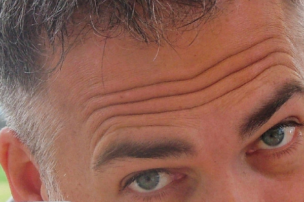 Konsiler von den dunklen Kreisen unter den Augen