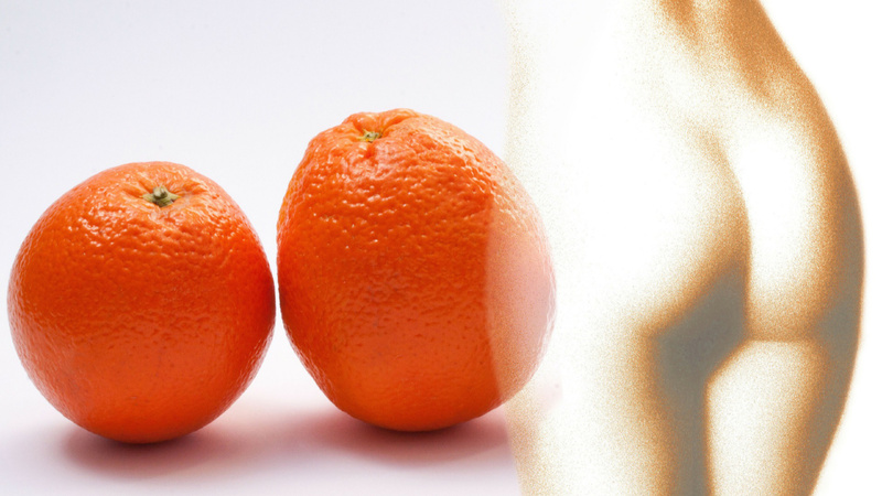 3-Punkte-Programm gegen Cellulite