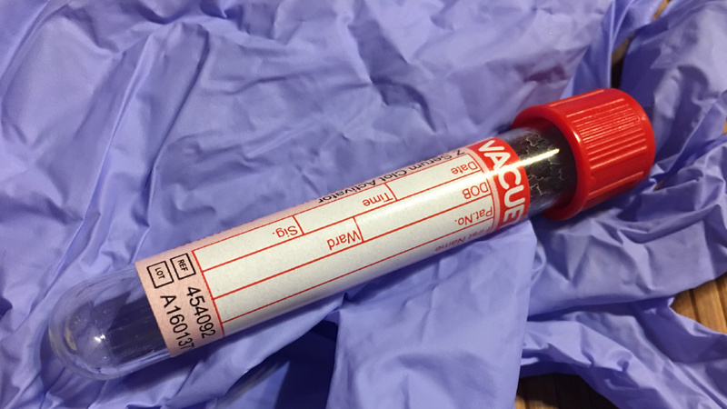 Une fiole pleine de sang