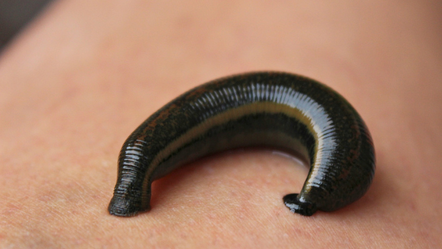 Une sangsue est posée sur la peau de quelqu'un